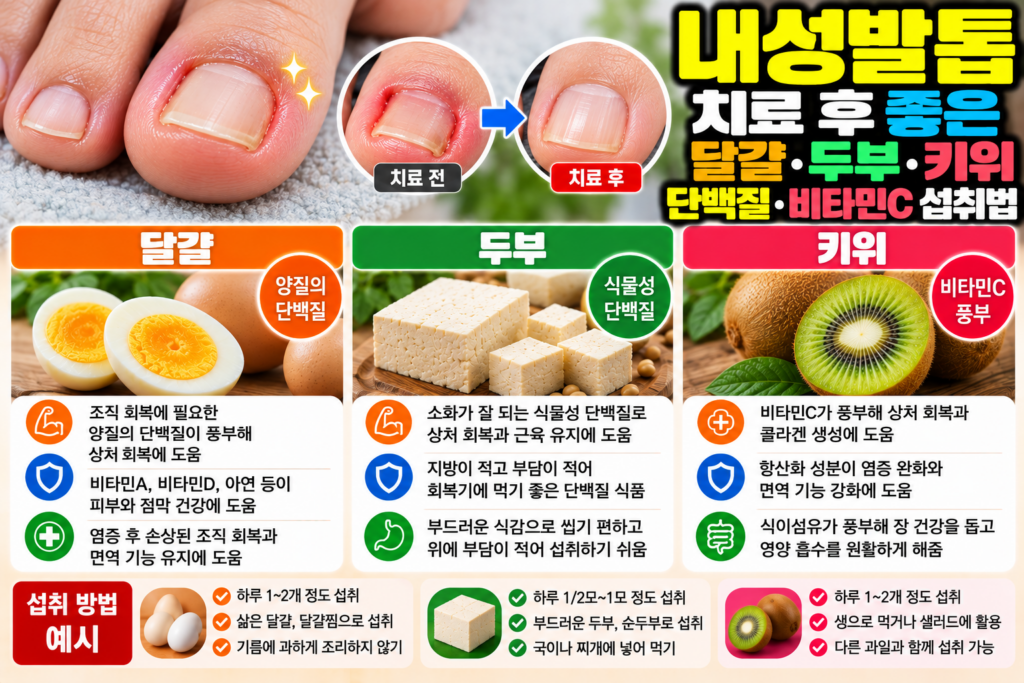 내성발톱 치료 후 좋은 달걀·두부·키위, 단백질·비타민C 섭취법