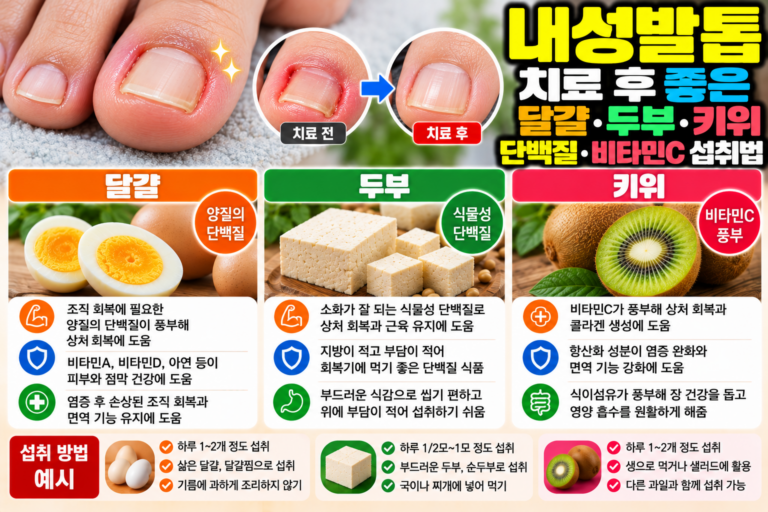 내성발톱 치료 후 좋은 달걀·두부·키위, 단백질·비타민C 섭취법