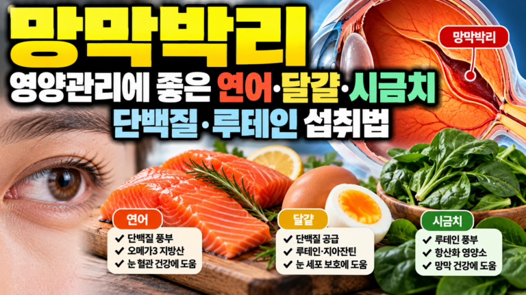 망막박리 영양관리에 좋은 연어·달걀·시금치, 단백질·루테인 섭취법