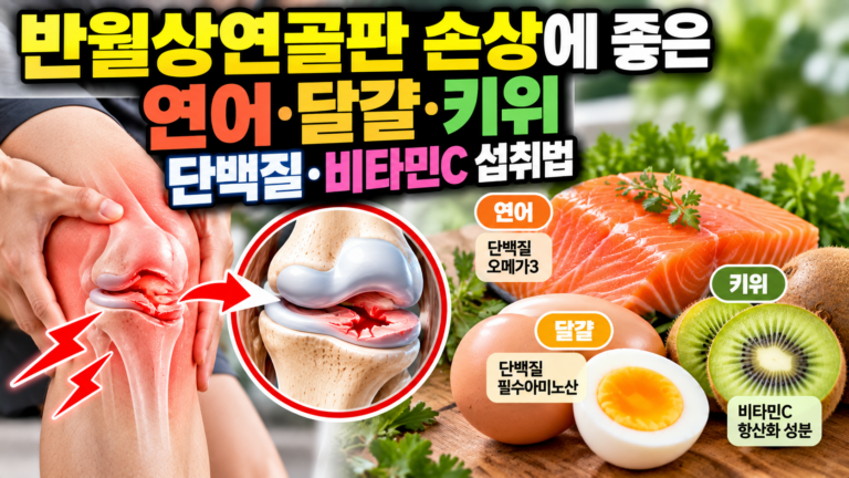 반월상연골판 손상에 좋은 연어·달걀·키위, 단백질·비타민C 섭취법 8 반월상연골판 손상 무릎이 걸리고 잠기는 이유
