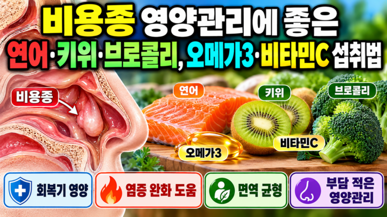 비용종 영양관리에 좋은 연어·키위·브로콜리, 오메가3·비타민C 섭취법