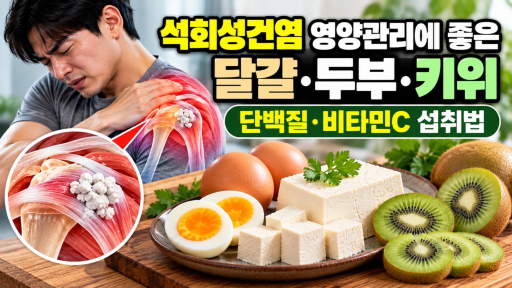 석회성건염 영양관리에 좋은 달걀·두부·키위, 단백질·비타민C 섭취법 1 석회성건염 영양관리에 좋은 달걀·두부·키위, 단백질·비타민C 섭취법