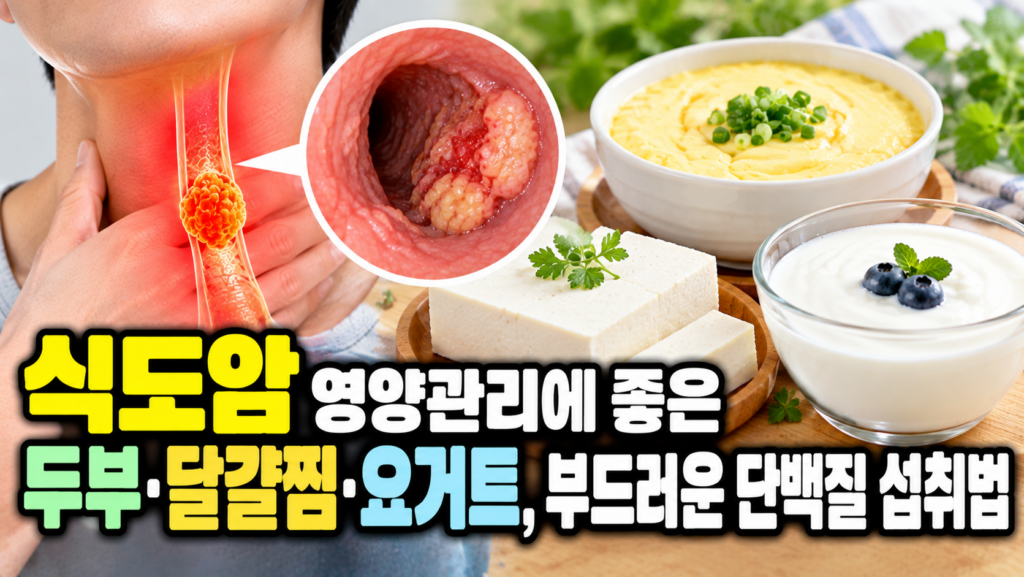 식도암 영양관리에 좋은 두부·달걀찜·요거트, 부드러운 단백질 섭취법 1 식도암 영양관리에 좋은 두부·달걀찜·요거트, 부드러운 단백질 섭취법