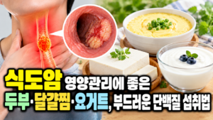 식도암 영양관리에 좋은 두부·달걀찜·요거트, 부드러운 단백질 섭취법