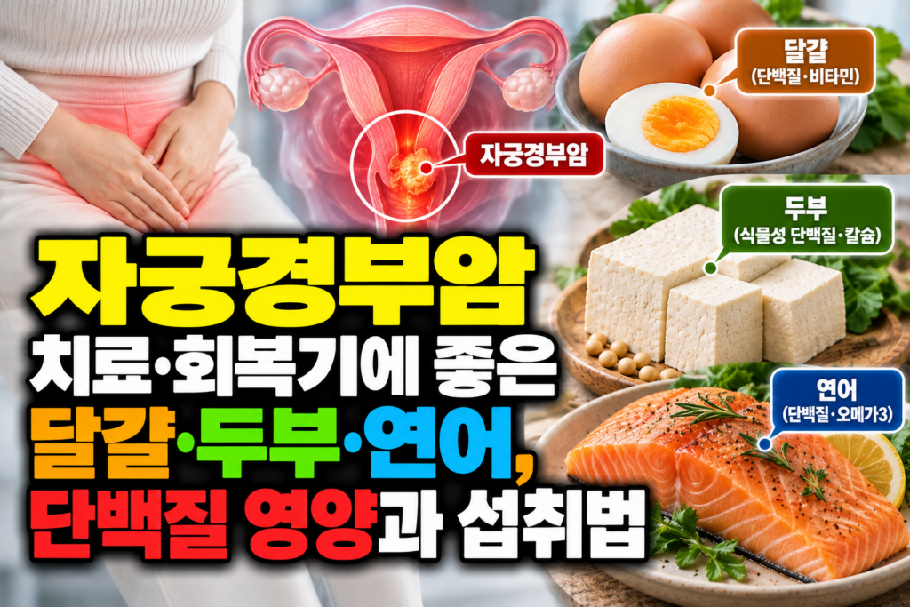 자궁경부암 치료·회복기에 좋은 달걀·두부·연어, 단백질 영양과 섭취법