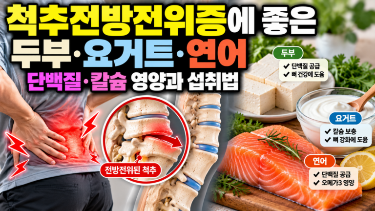 척추전방전위증에 좋은 두부·요거트·연어, 단백질·칼슘 영양과 섭취법